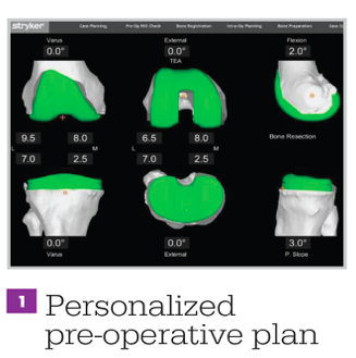 personalized pre-operative plan